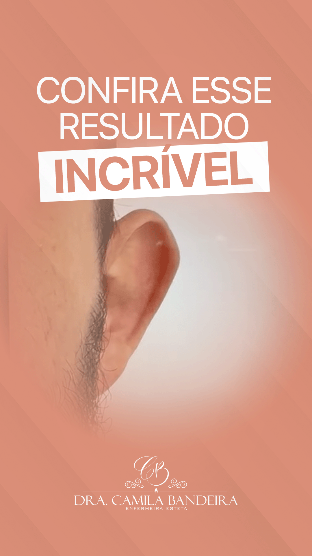 Capa do vídeo