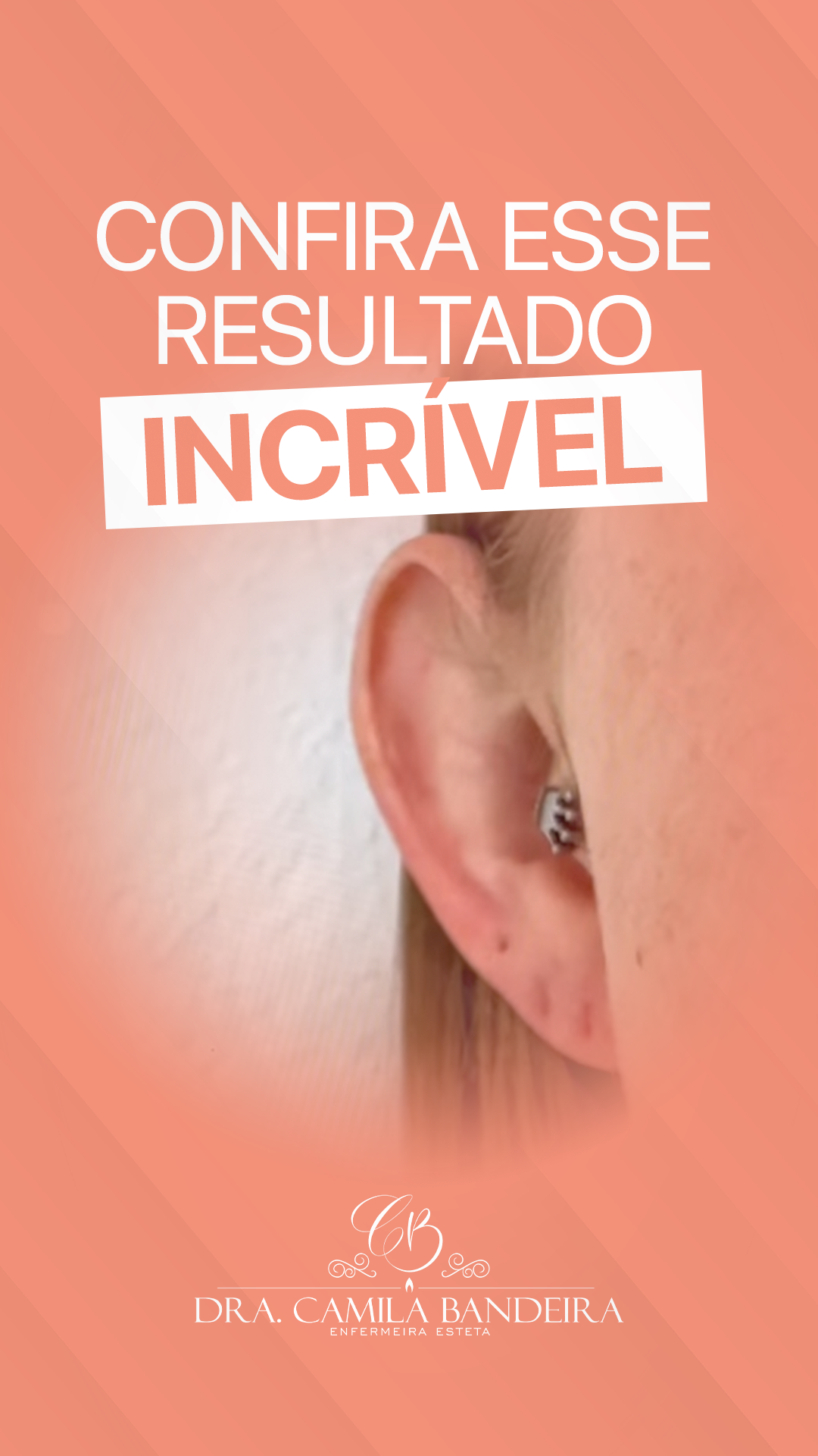 Capa do vídeo