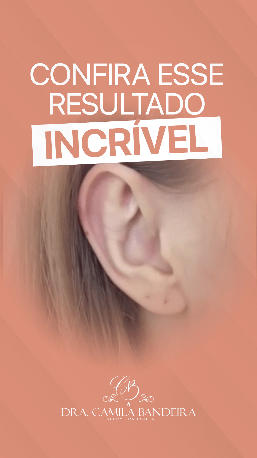 Capa do vídeo